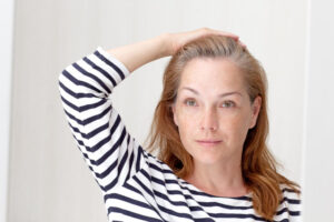 A woman with thinning temples